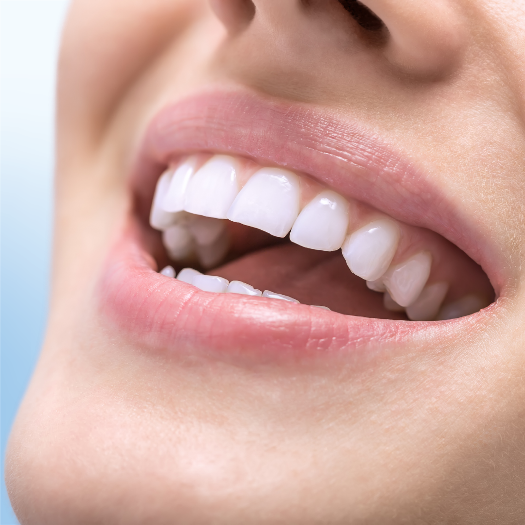 Vitis Whitening Zahnpasta + Mundspülung Kombi-Paket