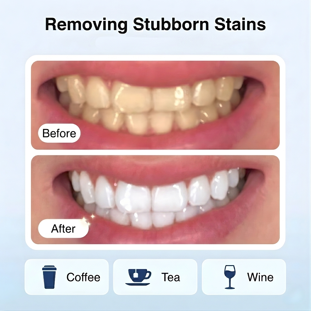 Crest 3D Whitening Strips Professional Effect Luxe