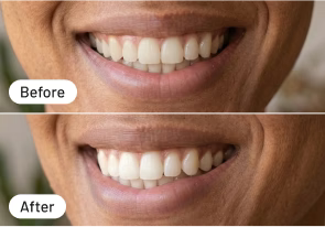 Kein klebriges Zeug!