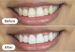 Wirklich keine Schmerzen!