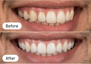 Ideal für Kaffeetrinker!