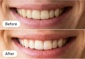 Keine Schmerzschübe mehr!