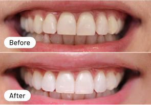 Schon nach 3 Mal ein Ergebnis!